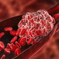 Understanding Blood Clots and the Potential Side Effects of Testosterone Replacement