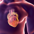 Understanding Heart Disease and Testosterone Replacement